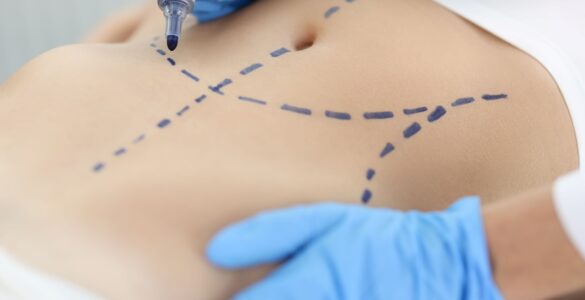 Cirurgia plástica: busca por resultados naturais é tendência