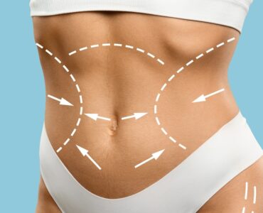 Tendências e tecnologia moldam o futuro da cirurgia plástica