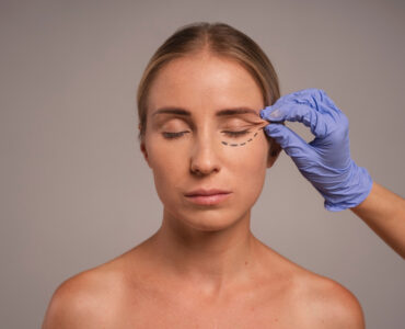 Estética do olhar adota abordagens para resultados naturais