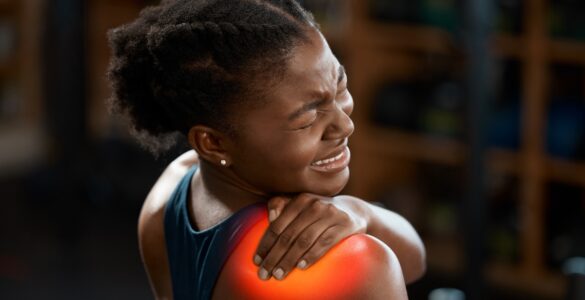 Cannabis medicinal surge como abordagem terapêutica para dor