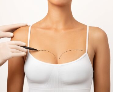 Resultados naturais são tendência em cirurgias plásticas