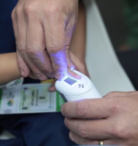 Errata: Identificação biométrica neonatal avança no Brasil