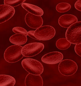 Mielodisplasia: doença silenciosa pode evoluir para leucemia