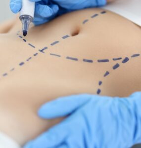 Cirurgia plástica: busca por resultados naturais é tendência