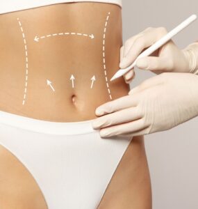 Cirurgia plástica corporal e de rejuvenescimento é tendência