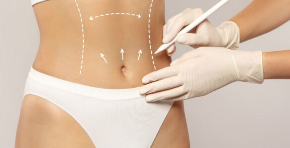 Cirurgia plástica corporal e de rejuvenescimento é tendência