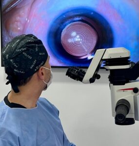 Cirurgia ocular promove independência do uso de óculos