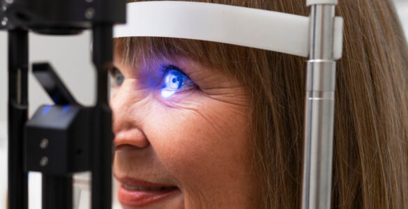 Procedimento a laser é alternativa para tratar o glaucoma