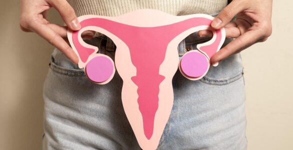 Endometriose requer atenção e plano terapêutico individuais