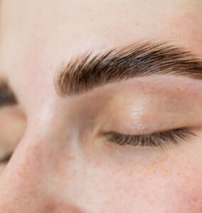 FUE Long Hair dá naturalidade ao transplante de sobrancelhas