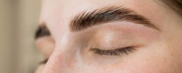 FUE Long Hair dá naturalidade ao transplante de sobrancelhas