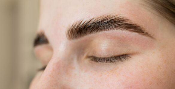 FUE Long Hair dá naturalidade ao transplante de sobrancelhas