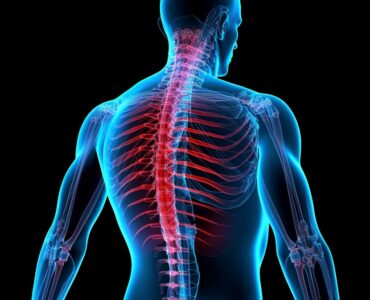 Técnicas minimamente invasivas tratam dores na coluna