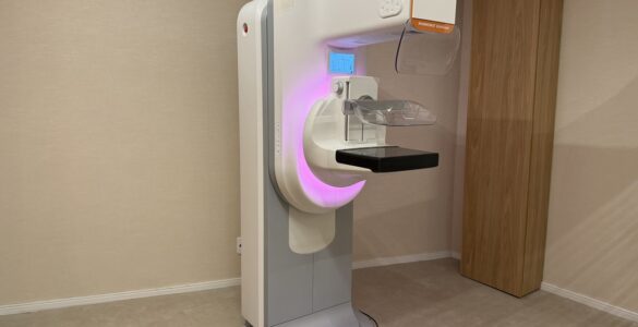 Um dos mamógrafos mais avançados do mundo chega ao Brasil