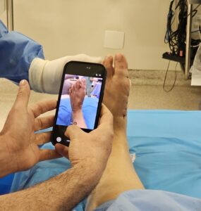 Tratamento das joanetes avança com cirurgia pouco invasiva
