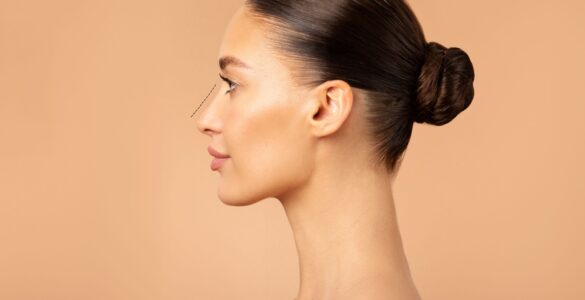 Rinoplastia ultrassônica gera avanços na estética facial