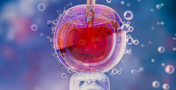 Pacientes recorrem ao uso do FGTS para custear FIV