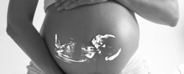 Equipes de cirurgia fetal realizam procedimento inédito