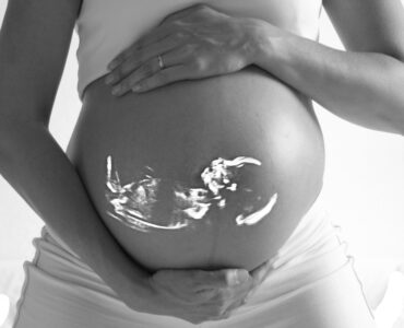 Equipes de cirurgia fetal realizam procedimento inédito