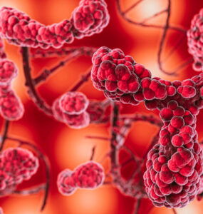 ANS avalia inclusão de tratamento para mielofibrose no rol