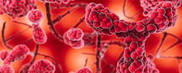 ANS avalia inclusão de tratamento para mielofibrose no rol