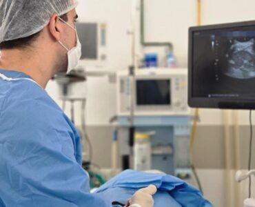 Biópsia transperineal revela câncer de próstata em 24h