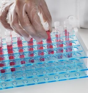 Escovas técnicas mantêm higienização eficiente de vidrarias em laboratórios