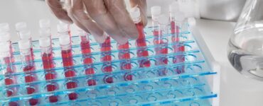 Escovas técnicas mantêm higienização eficiente de vidrarias em laboratórios