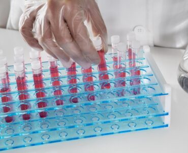 Escovas técnicas mantêm higienização eficiente de vidrarias em laboratórios