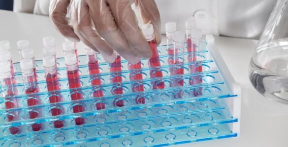 Escovas técnicas mantêm higienização eficiente de vidrarias em laboratórios