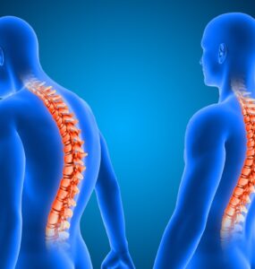 Cirurgia de escoliose é a 1ª com neuronavegação em Uberlândia