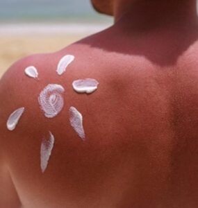 NoSunscreen: movimento viral preocupa especialistas
