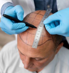 Clínica Artisti oferece tratamentos capilares personalizados