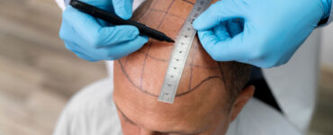 Clínica Artisti oferece tratamentos capilares personalizados