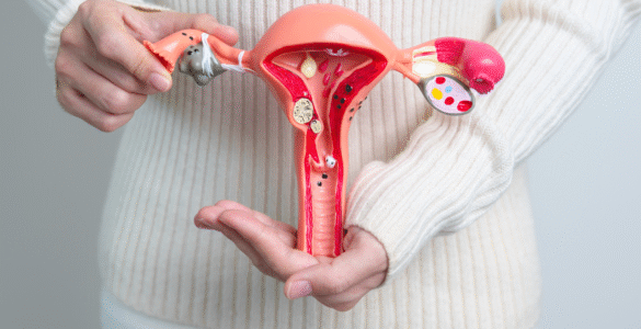 Endometriose severa: cirurgia robótica pode reduzir dor e riscos