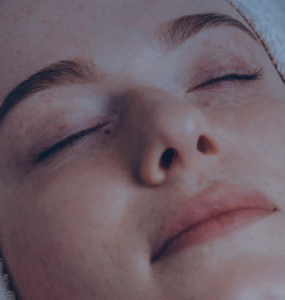 Técnica de microagulhamento ganha novas tecnologias em 2025