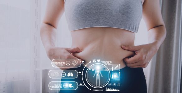 Tratamento clínico amplia alternativas contra a obesidade