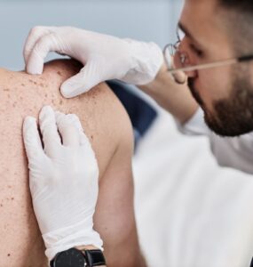 Desinformação e estigmas sobre a hanseníase atrasam cuidados