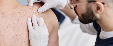 Desinformação e estigmas sobre a hanseníase atrasam cuidados