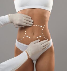 Cirurgia plástica avança com técnicas mais personalizadas