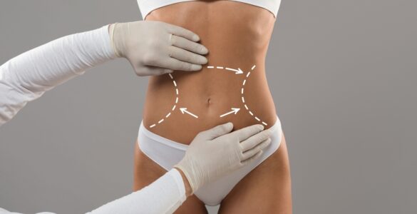 Cirurgia plástica avança com técnicas mais personalizadas