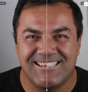 Tecnologia ajuda dentistas a prever resultados estéticos