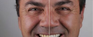 Tecnologia ajuda dentistas a prever resultados estéticos