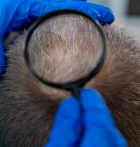 Tricologia ganha espaço no cuidado com a queda capilar