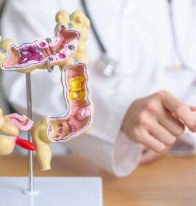 Campanha Março Azul alerta para o câncer colorretal