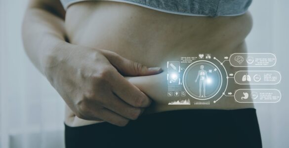 Distúrbio metabólico e obesidade afetam saúde geral do corpo