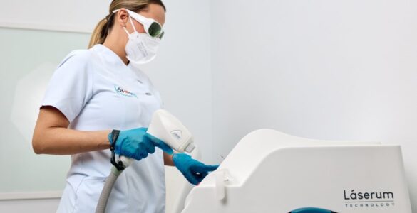 Entenda o que é a depilação definitiva com laser de díodo