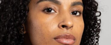 Mês de Conscientização da Acne incentiva cuidados especiais