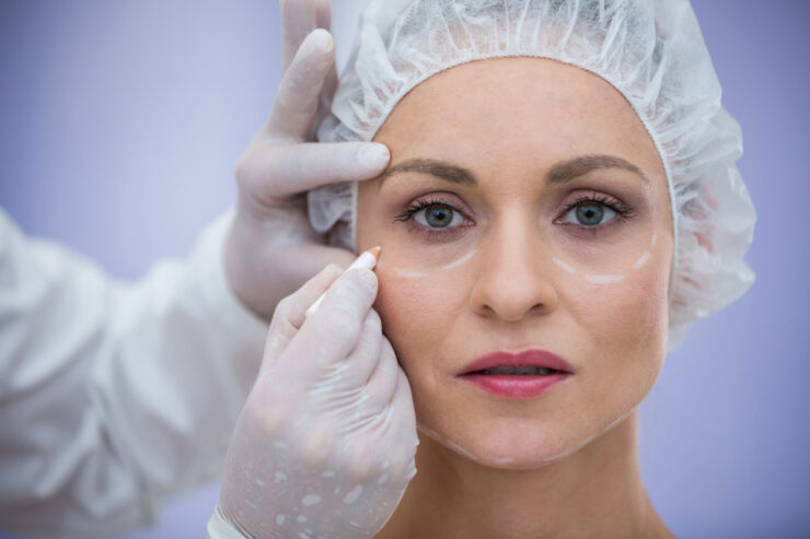 Cirurgia das pálpebras melhora aparência e visão