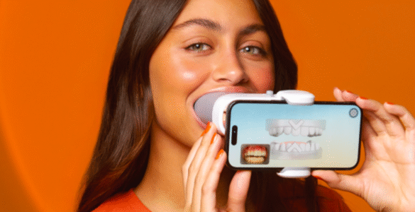 SouSmile lança monitoramento remoto com IA inédito no Brasil